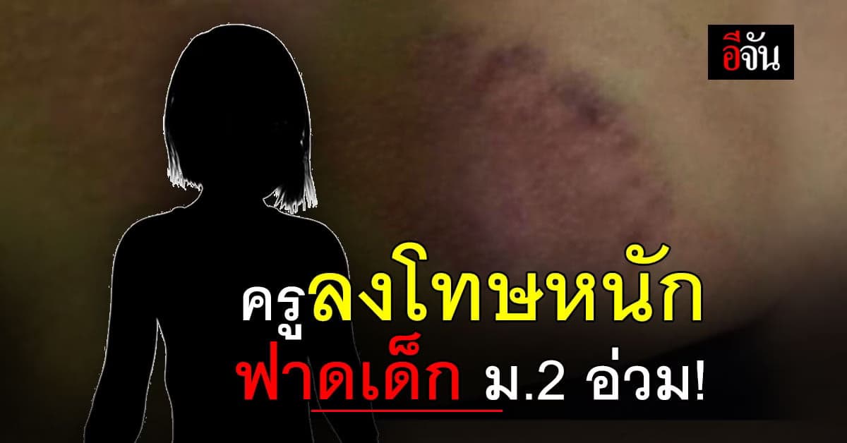 สะเทือนใจ ครูลงโทษหนัก ฟาด เด็กหญิง ม.2 ก้นช้ำ