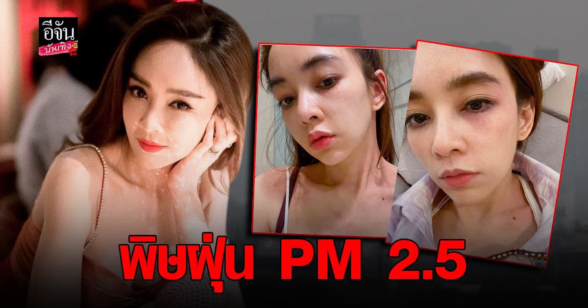 เป้ย ปาดวาด เผยอาการ แพ้ฝุ่นPM2.5