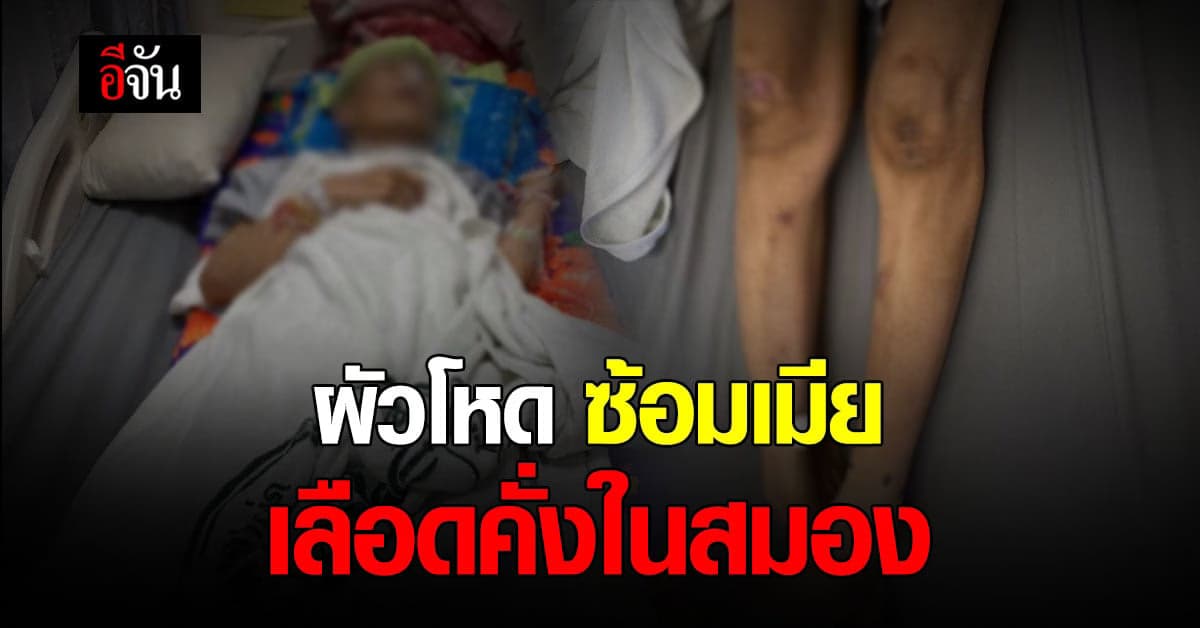 พ่อร้อง ปวีณา ลูกสาว ถูกผัวซ้อม จนเลือดคั่งในสมอง