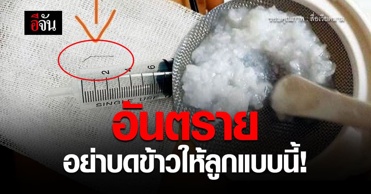 อุทาหรณ์ ใช้ตะแกรงบดข้าวให้ลูก ลวดหลุด ติดคอเด็ก อันตรายถึงชีวิตลูก!