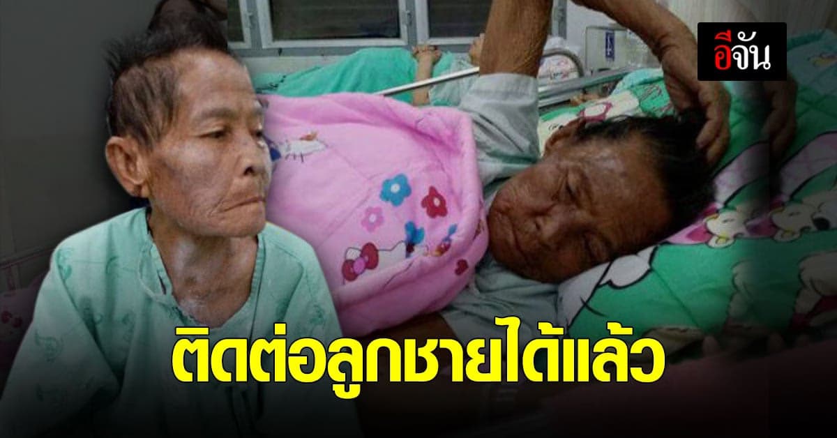 ขอบคุณพลังโซเชียล ยายป่วยมะเร็งระยะสุดท้าย ติดต่อลูกชายได้แล้ว หลังอยากเจอครั้งสุดท้าย