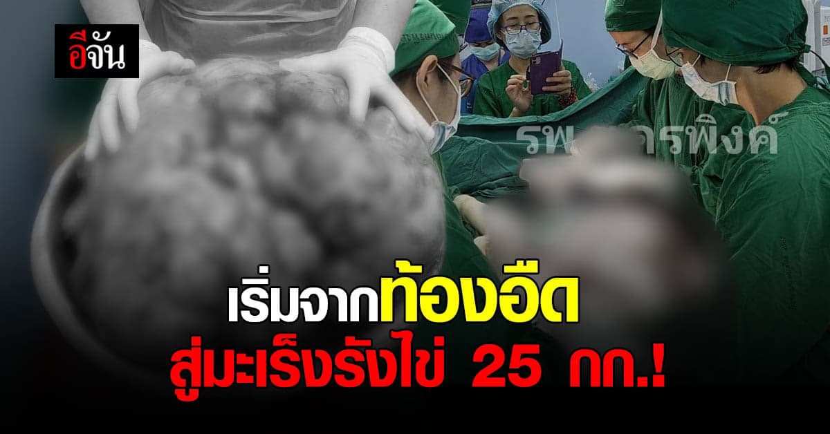 โรงพยาบาลนครพิงค์ ผ่าตัด มะเร็งรังไข่ น้ำหนักกว่า 25 กิโลกรัม!
