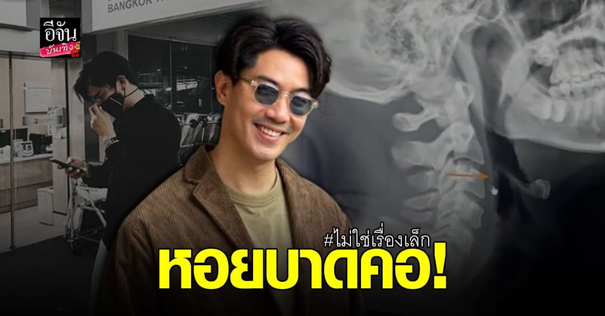 เป๊ก เปรมณัช วอนผู้รู้แนะนำวิธีรักษาหลังโดน หอยบาดคอ