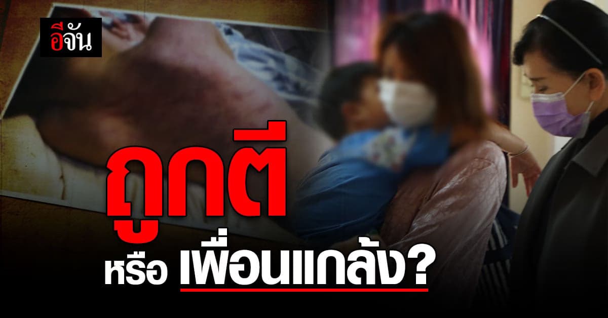 พ่อแม่ร้องปวีณา ลูกชายวัย 3 ขวบ กลับจากโรงเรียน กลับพบร่องรอยถูกทำร้ายเต็มหลัง !