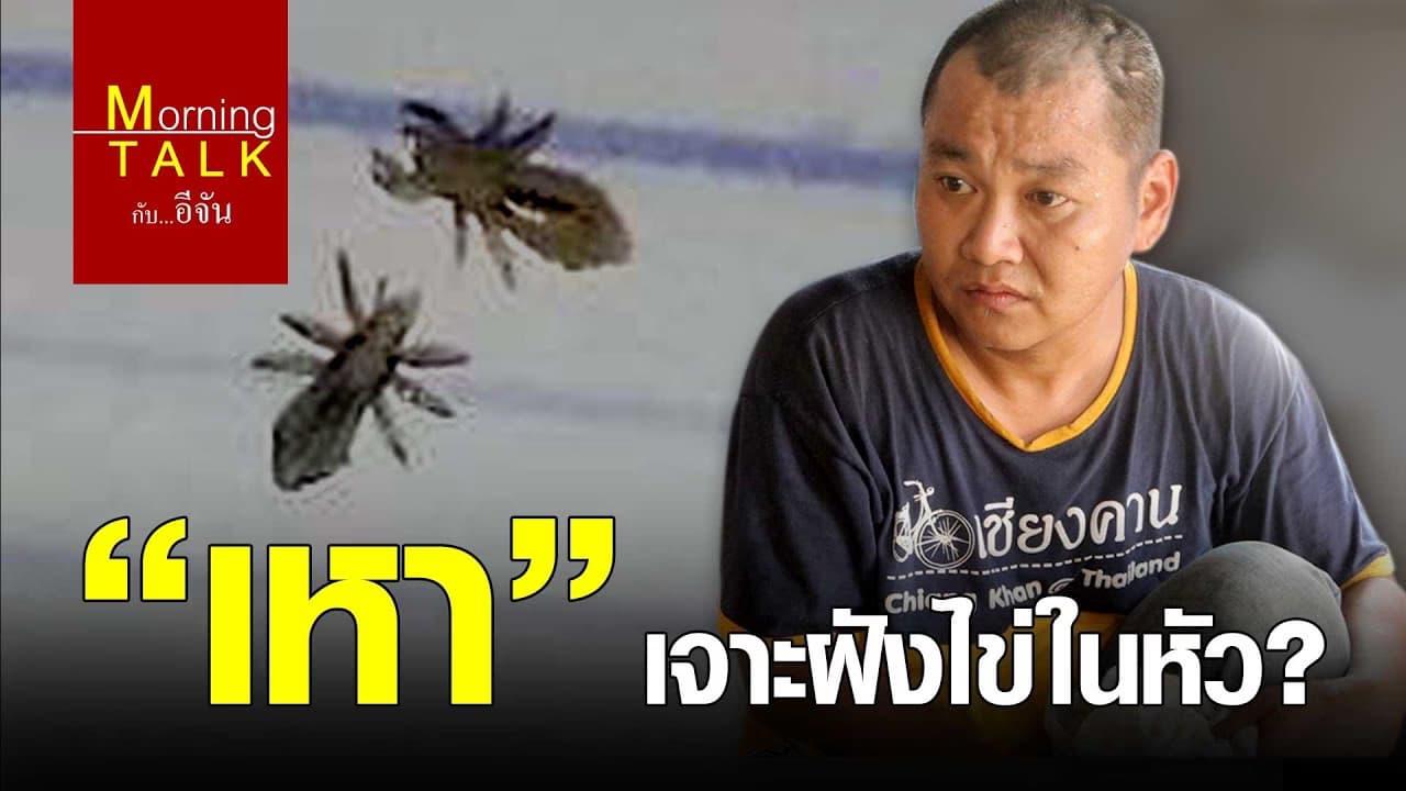 (Video) “เหา” เจาะฝังไข่ในหัว?
