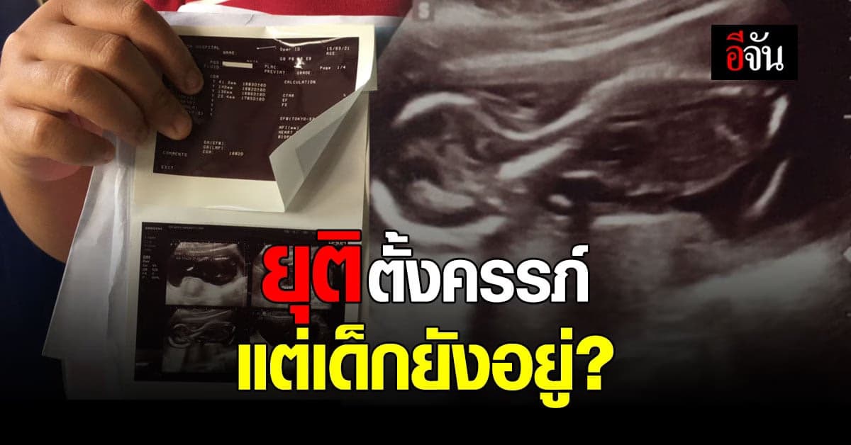 สาว 19 สุดงง! ครรภ์เป็นพิษ  ยุติการตั้งครรภ์ไปแล้ว แต่เด็กยังโตในท้อง