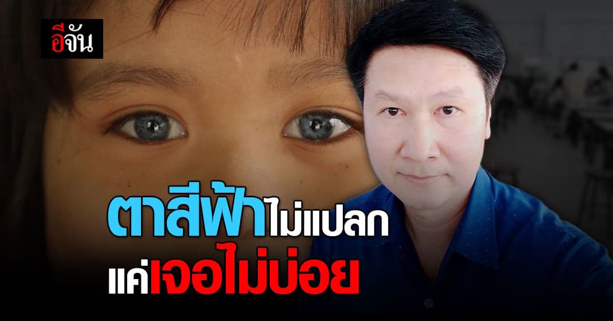 หนูน้อย ตาฟ้า อ.เจษฎา ชี้ ไม่ใช่เรื่องแปลก แค่เจอไม่บ่อย