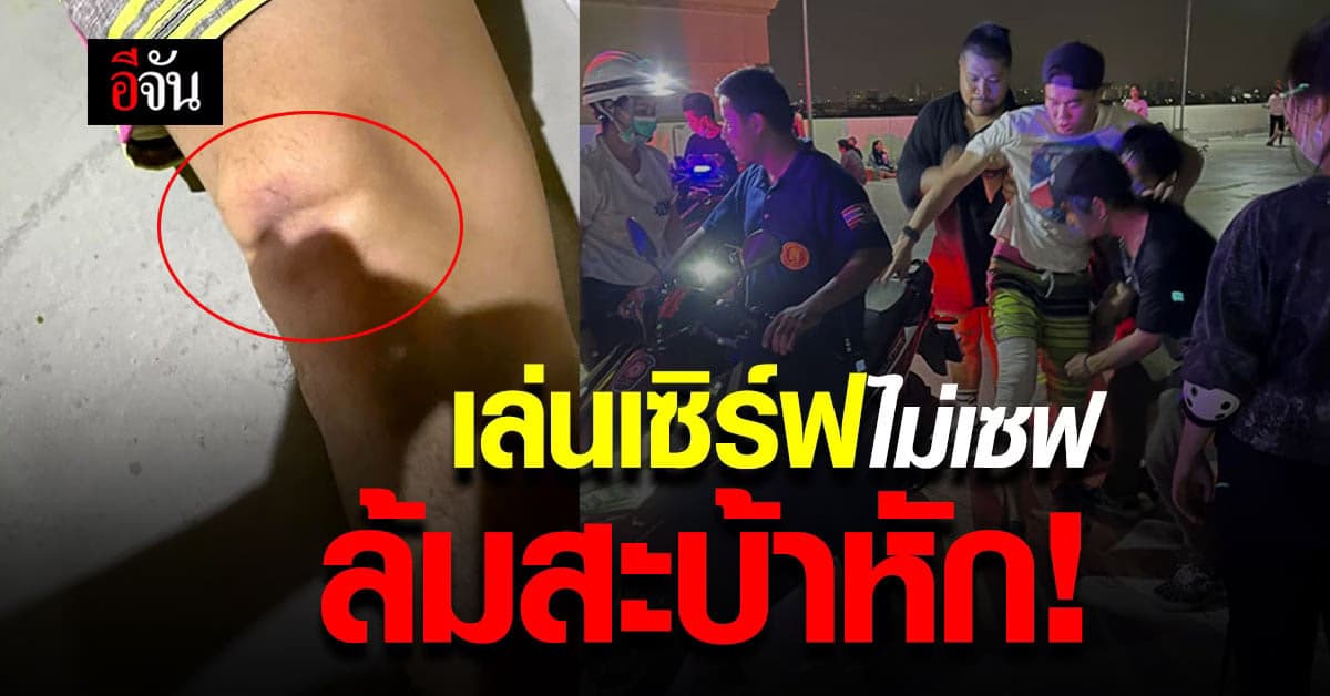 เซิร์ฟสเก็ต เป็นเหตุ ล้มครั้งเดียว สะบ้าหัก ค่ารักษาหลักแสน!