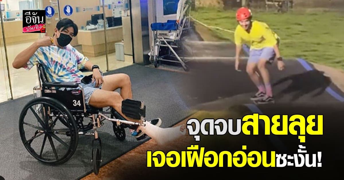 เป๊ก เปรมณัช เตือนไถบอร์ดอย่างมีสติ หลังพลาดจนต้อง เข้าเฝือกอ่อน