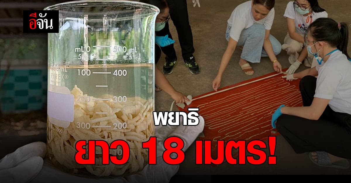 ชอบกินเนื้อวัวดิบ ถ่ายออกมาเจอพยาธิตัวเดียว 18 เมตร!