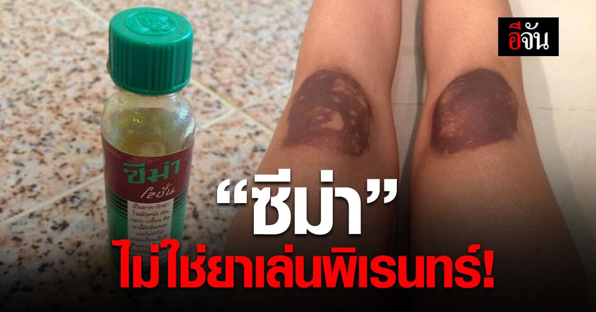 อ.เจษฯ เตือน ซีม่าโลชั่น เป็นยารักษาโรค ไม่ควร เอาเล่นพิเรนทร์