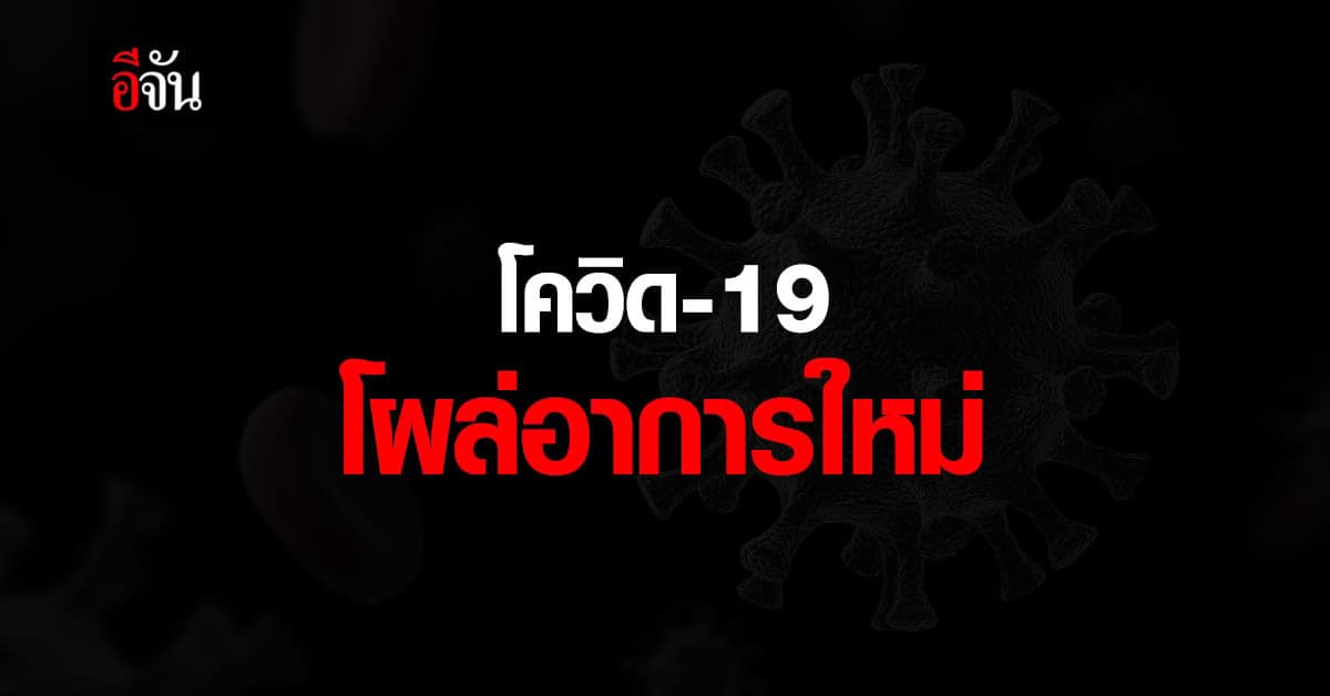 สธ.สังเกต พบอาการโควิด รูปแบบใหม่ ตาแดง ไม่มีไข้ มีผื่น