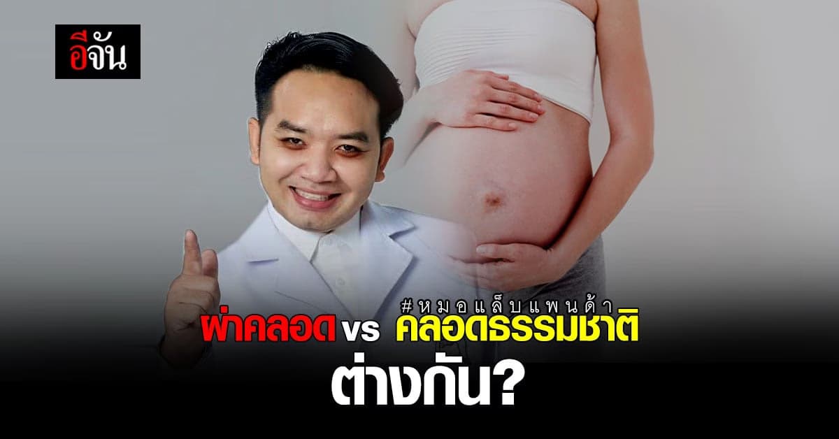 หมอแล็บแพนด้า ระบุ เด็กผ่าคลอด อาจมี ภูมิต้านทานตั้งต้น ต่างจาก เด็กคลอดธรรมชาติ