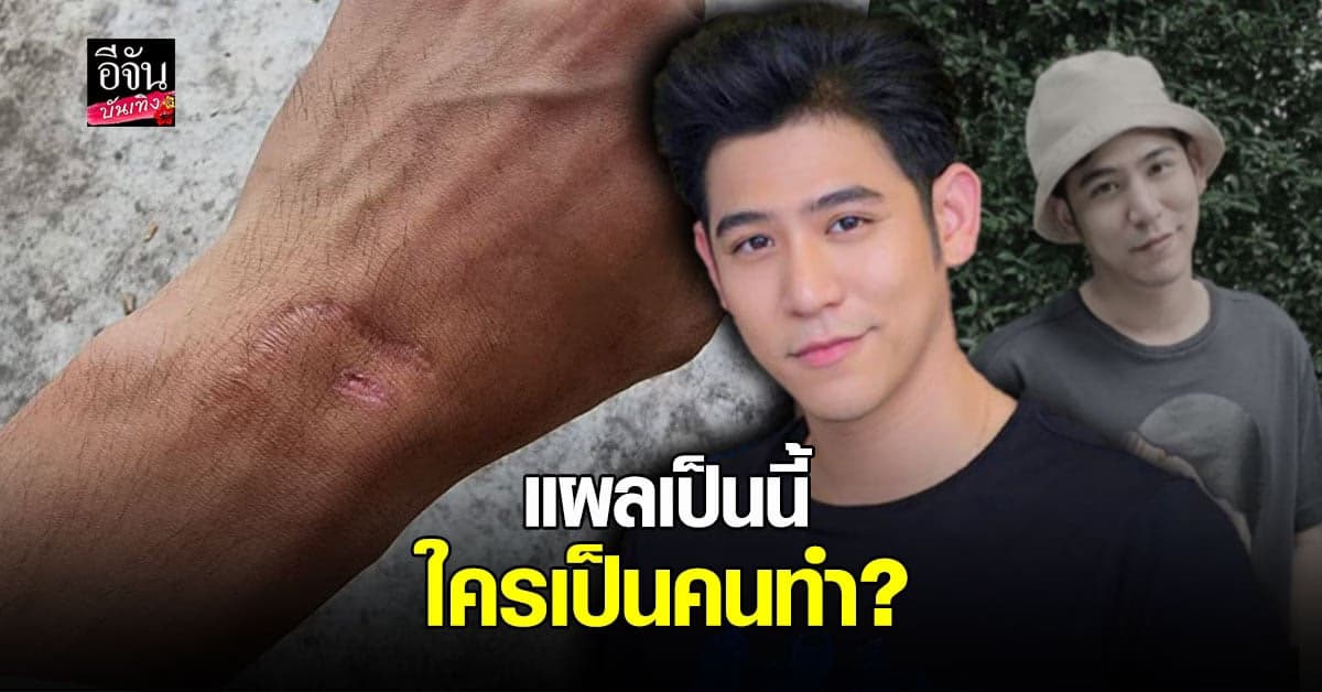 ลูกผู้ชายพอ พอร์ช โชว์ แผลที่ข้อมือ ลั่น รักจบลงแบบไหน ไม่จำเป็น ต้องเหยียบย่ำกัน