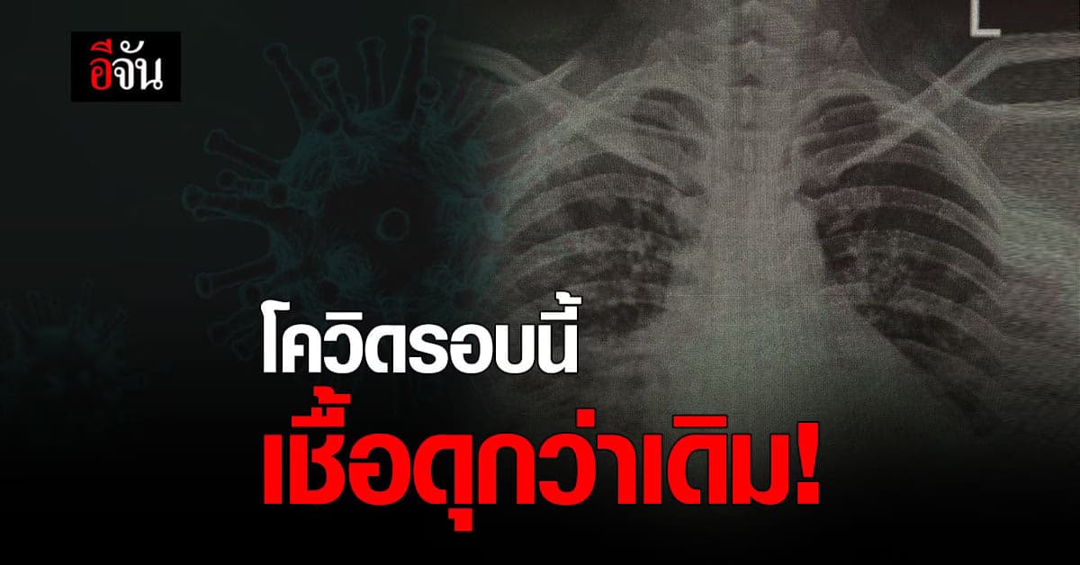 แพทย์ชี้ โควิดรอบนี้เชื้อดุ พบวัยรุ่นปอดอักเสบมากขึ้น!