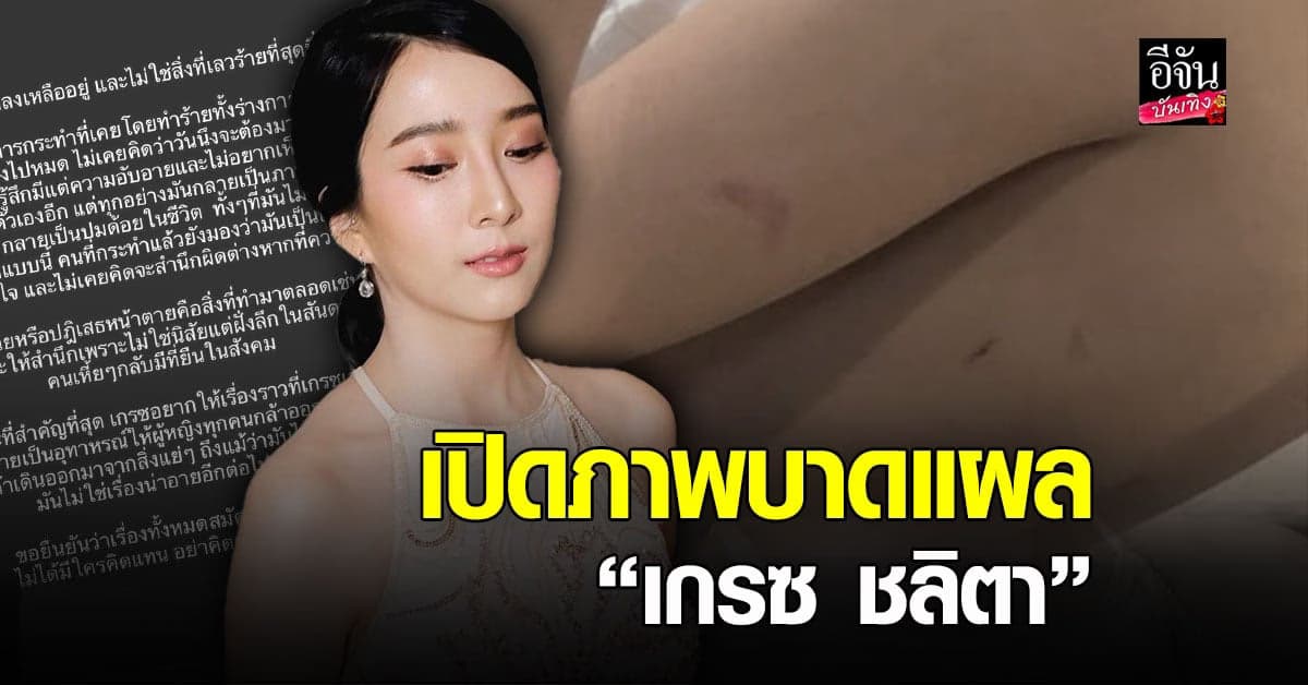 สมัครใจพูดเอง เกรซ ชลิตา เปิด ภาพบาดแผล ด้าน ดาว พิมพ์ทอง คอมเมนต์ให้กำลังใจ