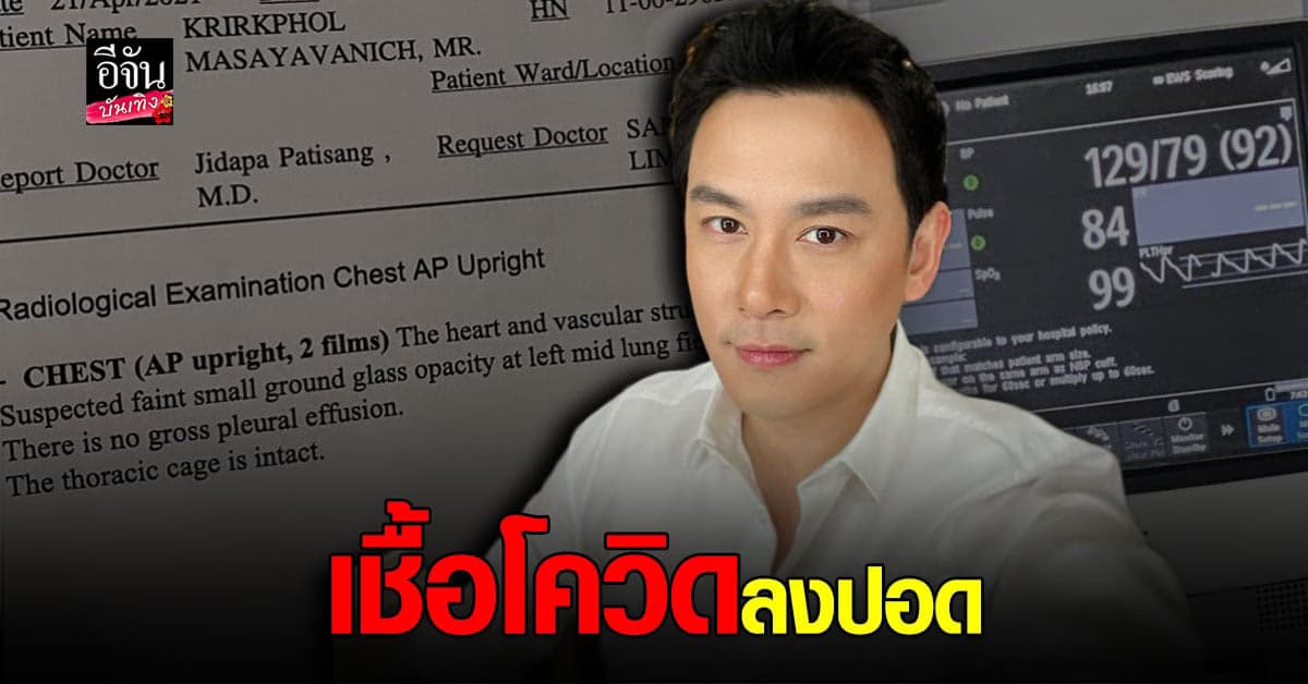 ฟลุค เกริกพล อัปเดตอาการ โควิด ล่าสุด เชื้อลงปอดแล้ว