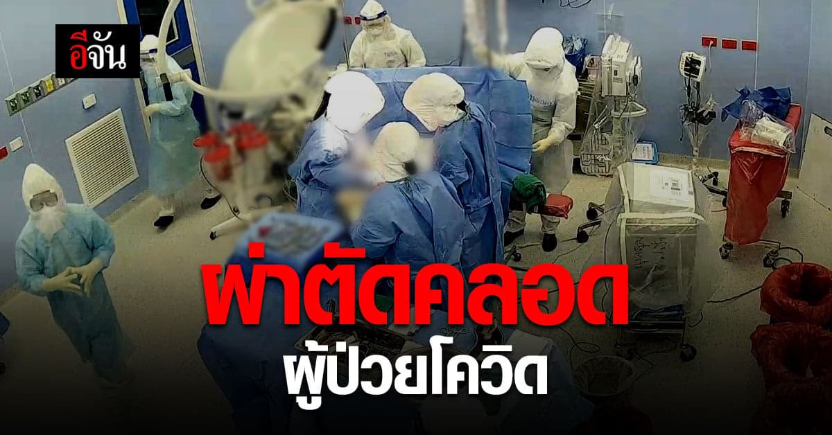 รพ.นครพิงค์ ผ่าตัดคลอดผู้ป่วยโควิด ปลอดภัยทั้งแม่และลูก