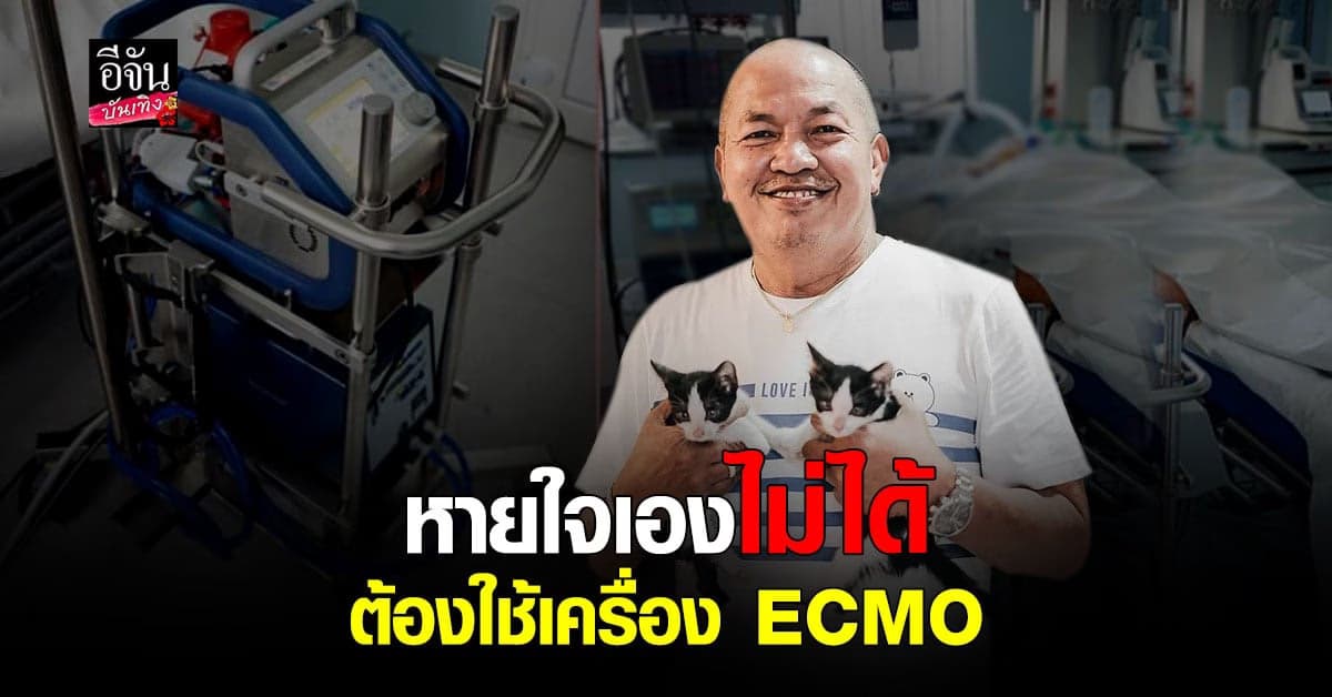 น้าค่อม ทรุดหนักต้องย้าย รพ. พึ่งเครื่อง ECMO เพราะเริ่มหายใจเองไม่ได้