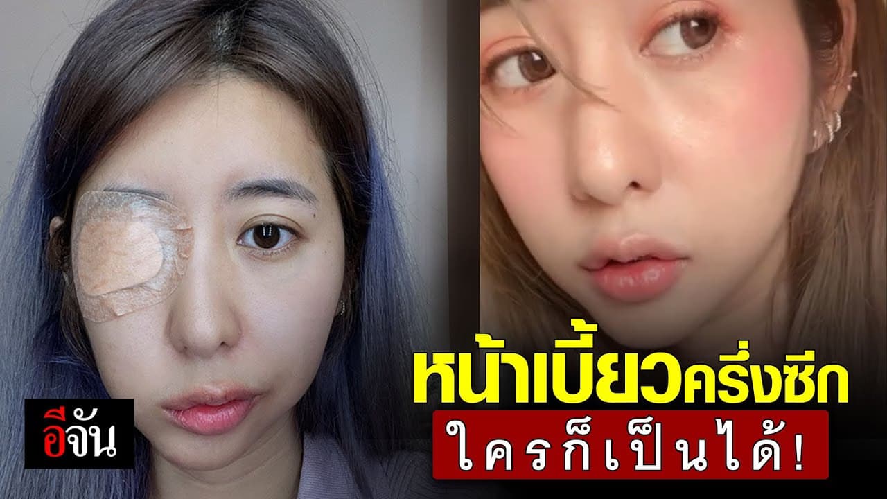(Video) หน้าเบี้ยวครึ่งซีก ใครก็เป็นได้!