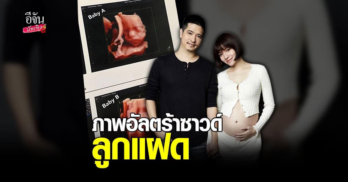 จ๊ะ จิตตาภา เผยภาพ อัลตร้าซาวด์ ลูกในท้องครั้งแรก ว้าว… แฝด น้อยจมูกโด่งมาก