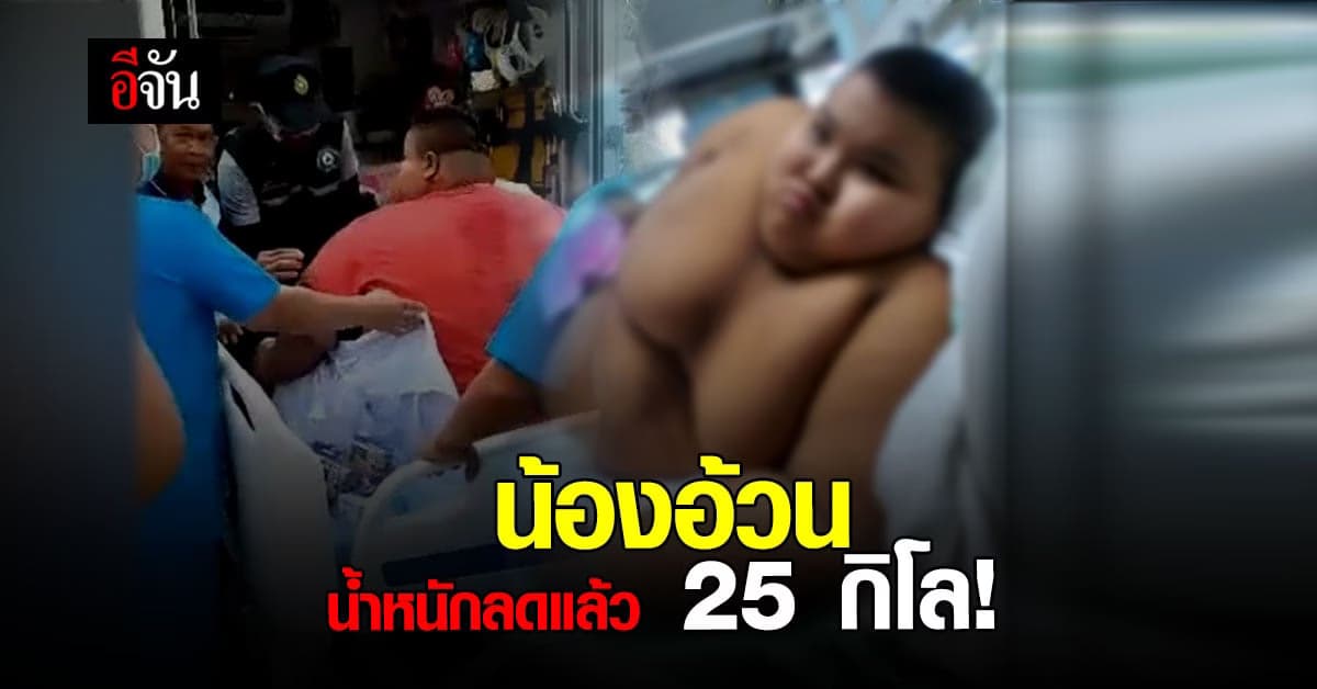 น้องอ้วน 200 กก. เข้ารับรักษา น้ำหนักลด 25 กิโล ภายใน 2 สัปดาห์