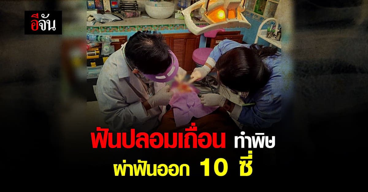 ระวังฟันปลอมเถื่อน มาติดถึงที่บ้าน ทำหลวงพ่อปวดฟัน ต้องถอนฟันถึง 10 ซี่