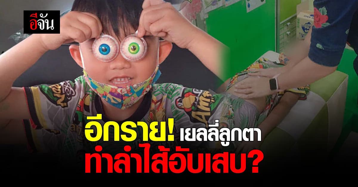 โผล่อีกราย! แม่โพสต์ลูกชายกิน เยลลี่ลูกตา ปวดท้อง ลำไส้อับเสบ