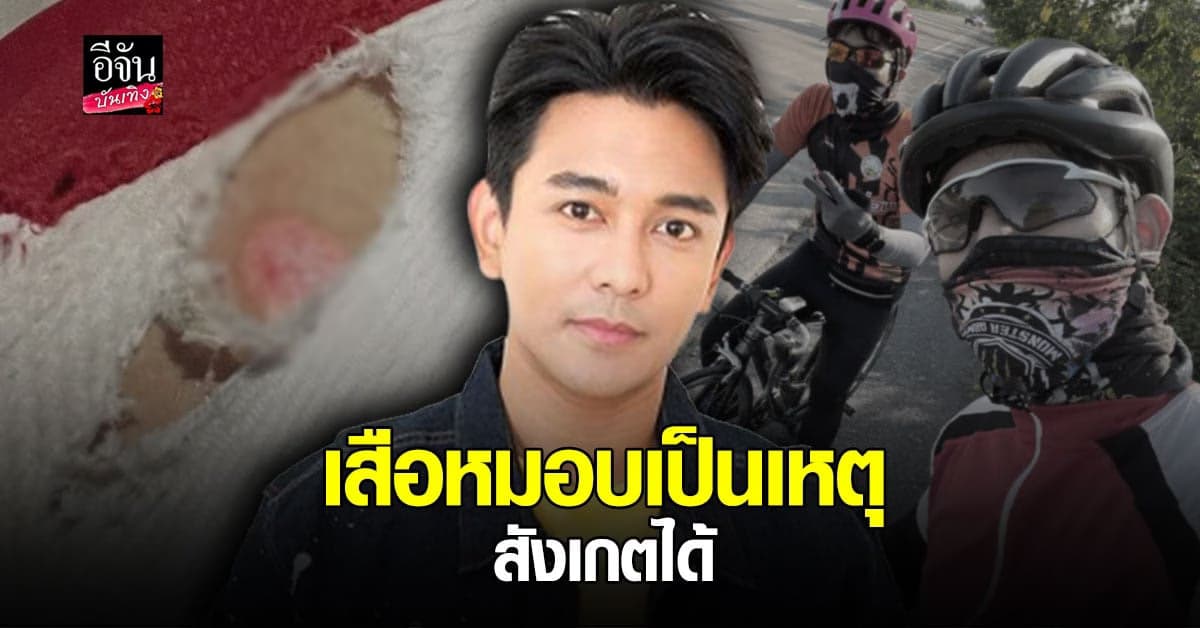 บาดแผลลูกผู้ชาย กัน นภัทร พลาดท่า ประสบอุบัติเหตุ จักรยานล้ม