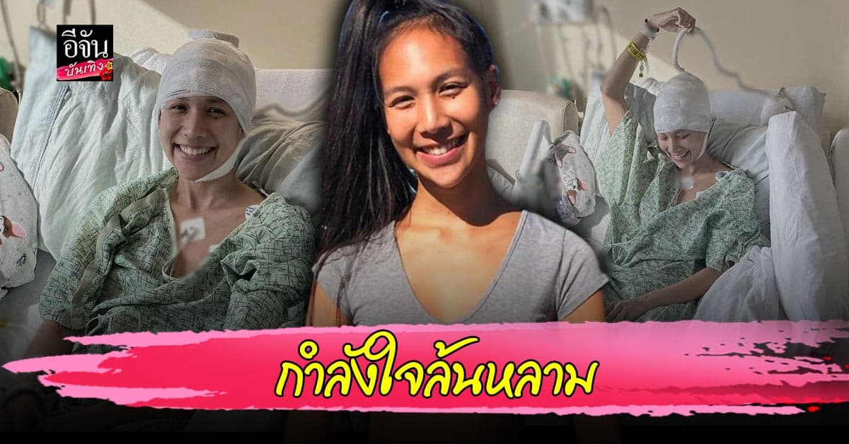 จ๋า ชิษณุชา สาวยูทูบเบอร์ชื่อดังป่วยเข้า รพ. เนื่องจากเกิดความผิดปกติจากระบบประสาทส่วนกลาง