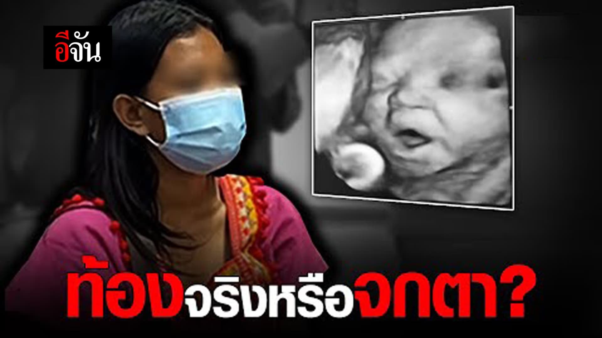 (Video) ท้องจริง หรือ ท้องทิพย์ หรือแค่จกตา?