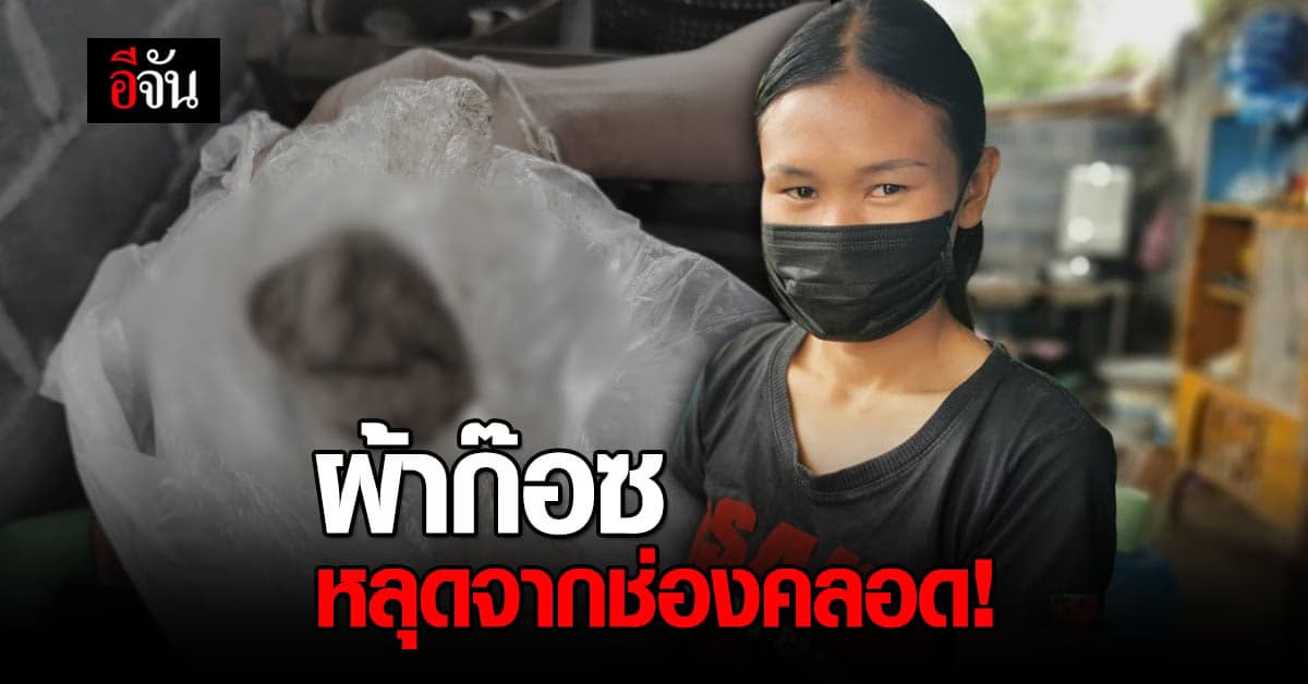 ช็อก สาวบุรีรัมย์ โวยหลังเจอ ผ้าก๊อซ หลุดจาก ช่องคลอด!
