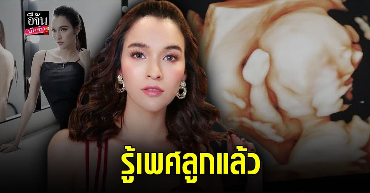 หยาดทิพย์ เผยภาพอัลตร้าซาวด์ ลูกในท้อง เผย รู้เพศแล้ว แต่อยากให้ลุ้น !
