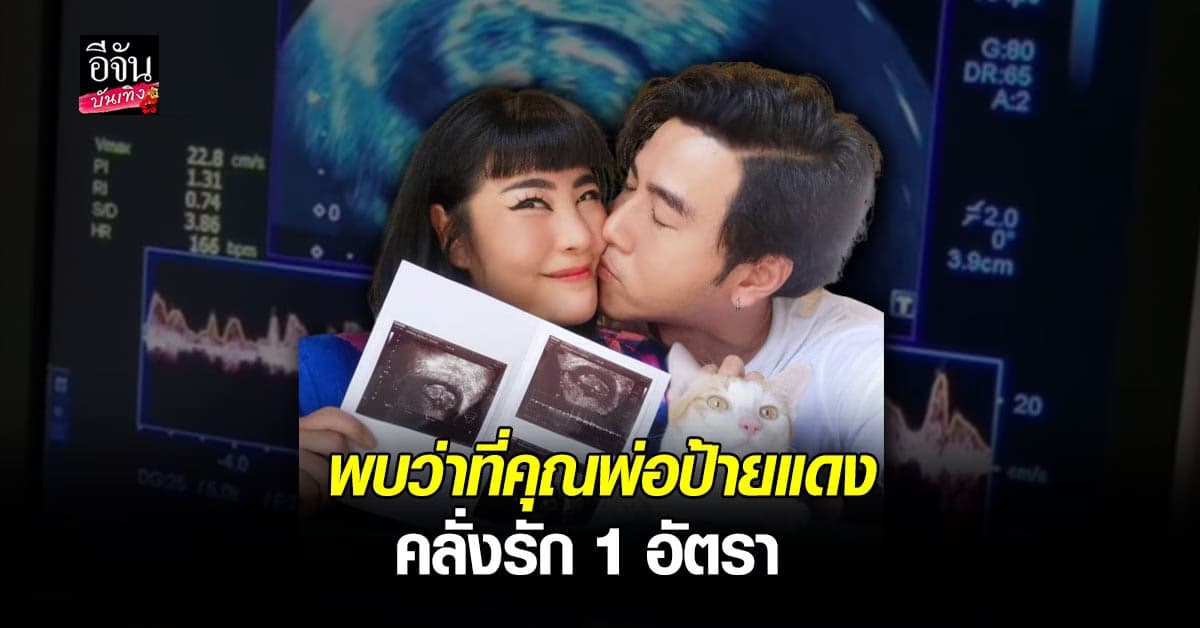 โย่ง อาร์มแชร์ คลั่งรักหนักมากหลังได้ยินเสียงหัวใจลูกในท้องภรรยาครั้งแรก