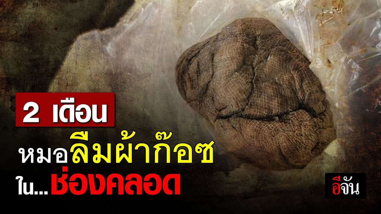 (Video) หมอลืมผ้าก๊อซคาช่องคลอดนาน 2 เดือน