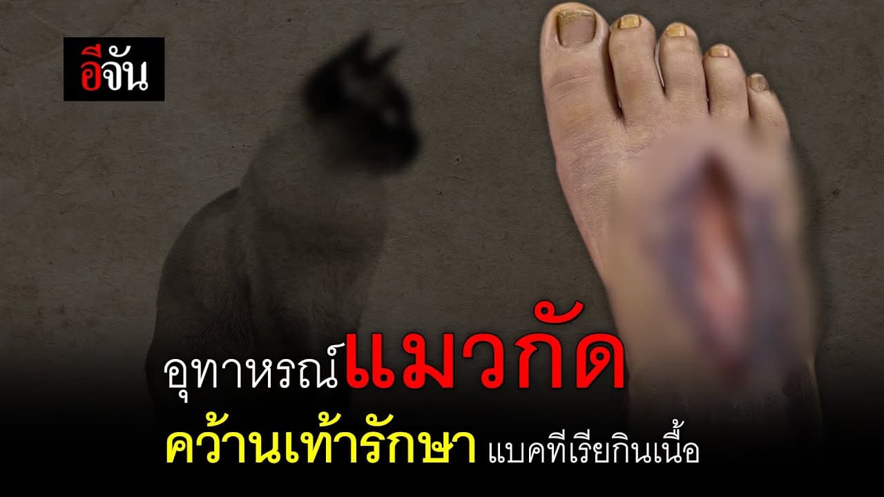 (video) อุทาหรณ์แมวกัด คว้านเท้ารักษา แบคทีเรียกินเนื้อ