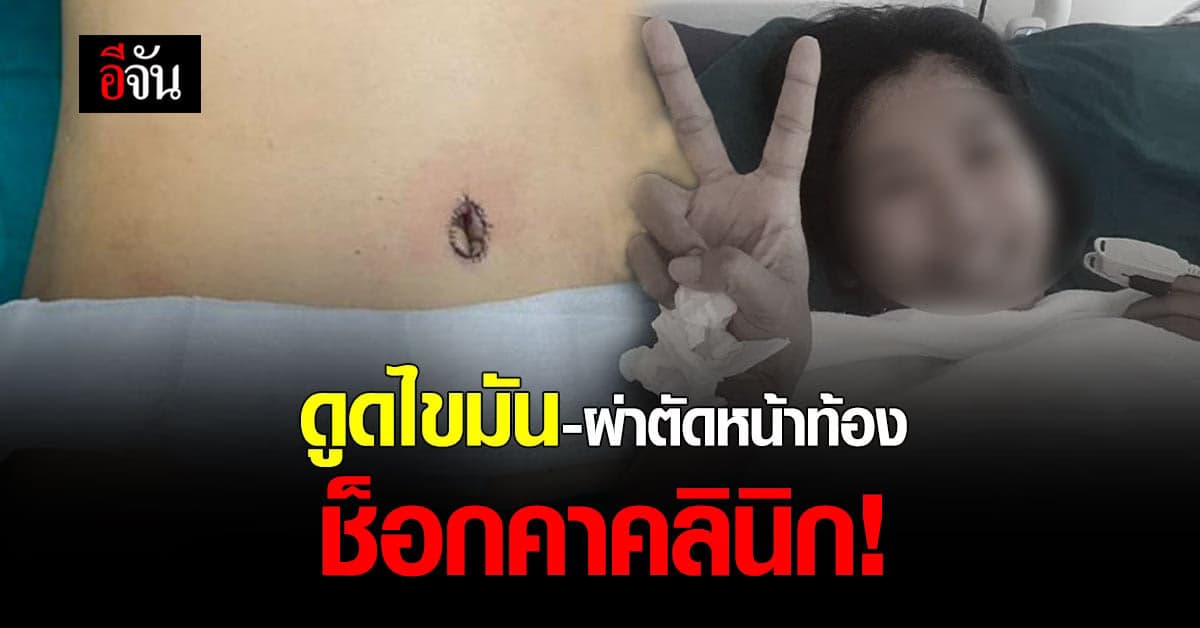 สาวอยากสวย ไปศัลยกรรมหน้าท้อง ช็อกคาคลินิก!