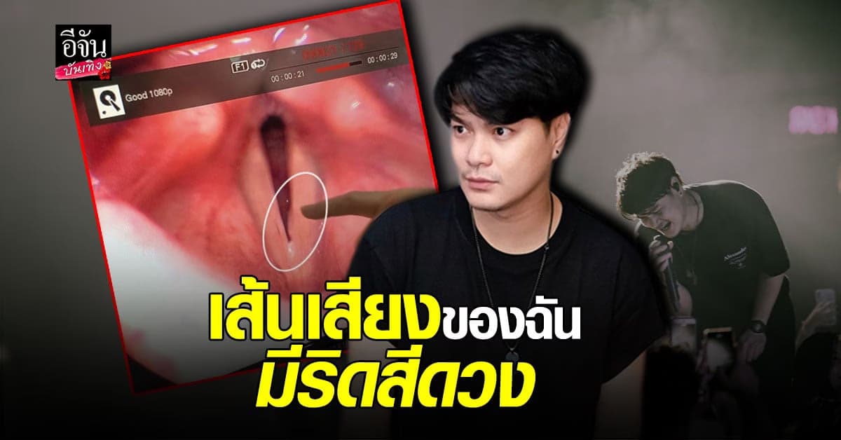 ถึงกับช็อค เมื่อหนุ่ม เป๊ก วงซีล ตรวจพบ ริดสีดวงเส้นเสียง วอนแฟนๆอย่าคิดลึก