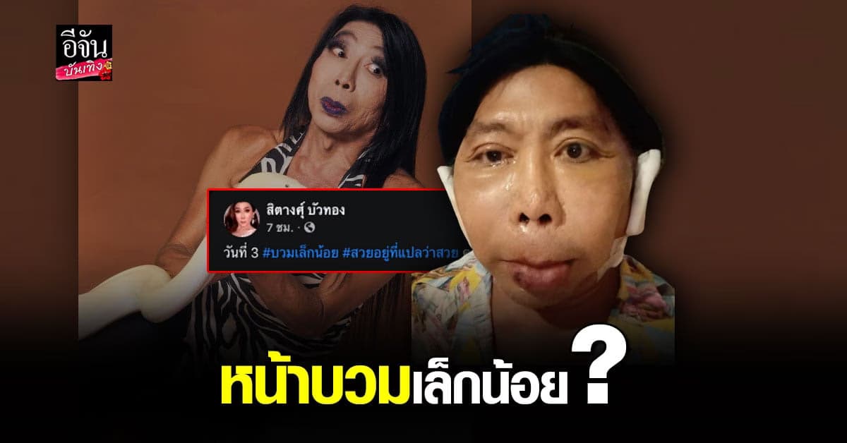 แม่สิตางศุ์ เผยภาพ หลัง โมหน้าใหม่ ได้ 3 วัน  บอก บวมเล็กน้อย