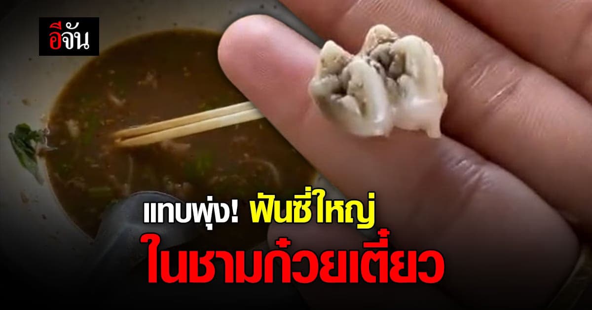 สุดอึ๋ย สาวโพสต์ ติ๊กต๊อก พบ ฟันซี่ใหญ่ ในชามก๋วยเตี๋ยว
