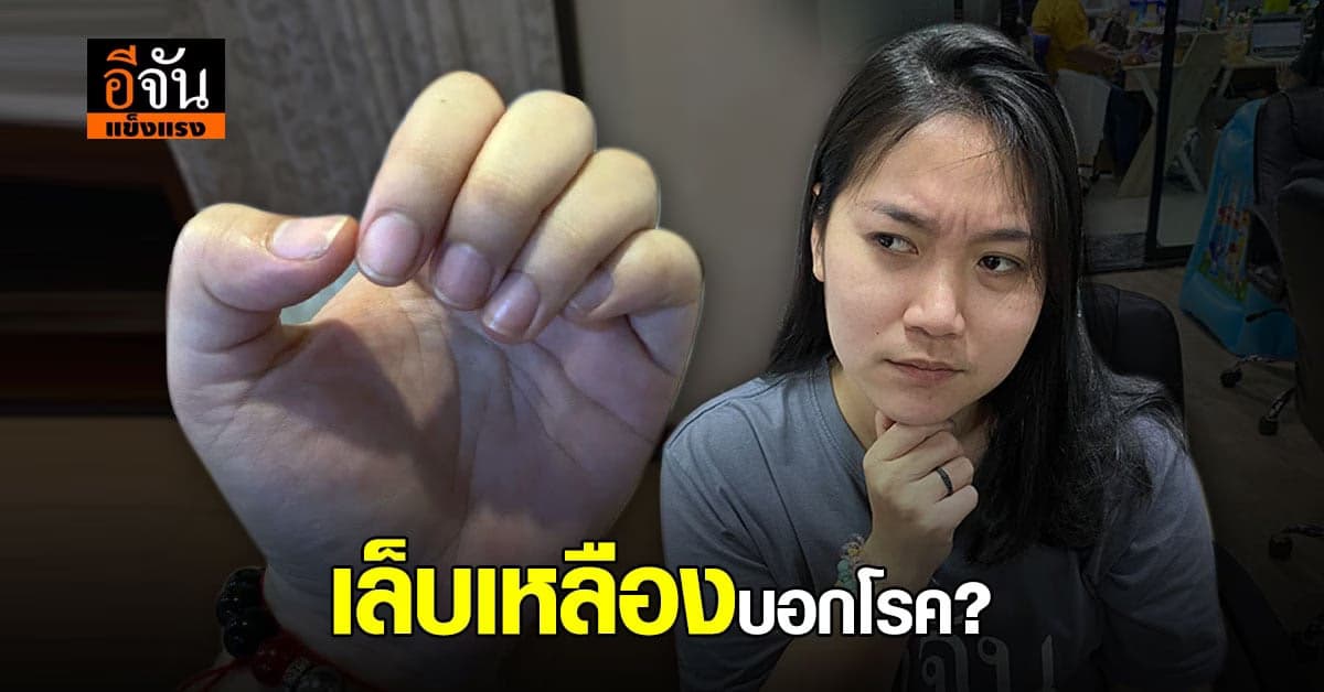 เช็กด่วน สัญญาณเตือน เล็บเหลือง อาจเกิดโรค