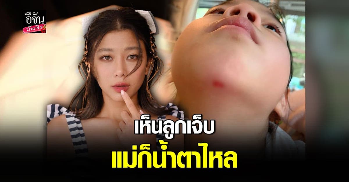 กุ๊บกิ๊บ ใจหาย สงสารลูก น้องเป่าเปา ลื่นล้ม คางแตก