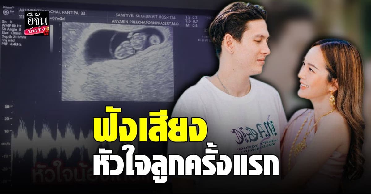 กวินท์ – ปุ้มปุ้ย ตื่นเต้นหนักมาก ไปตรวจครรภ์ ฟังเสียงหัวใจเบบี๋ครั้งแรก