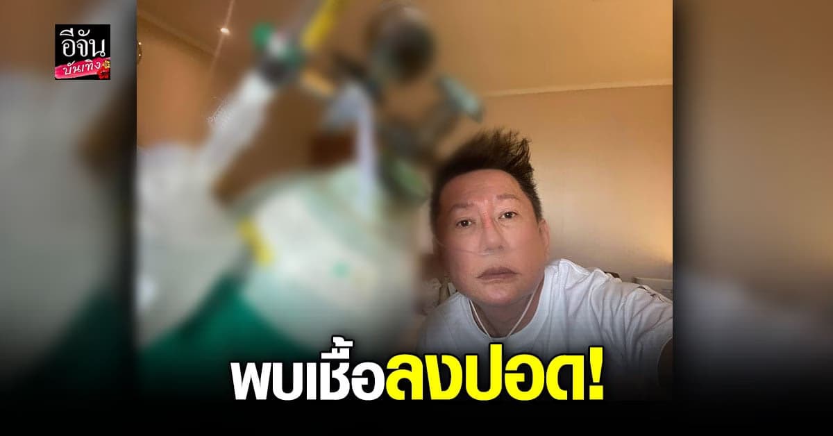 ณวัฒน์ อัปเดตอาการ โควิด-19  ล่าสุด พบเชื้อบางส่วนลงปอดแล้ว!