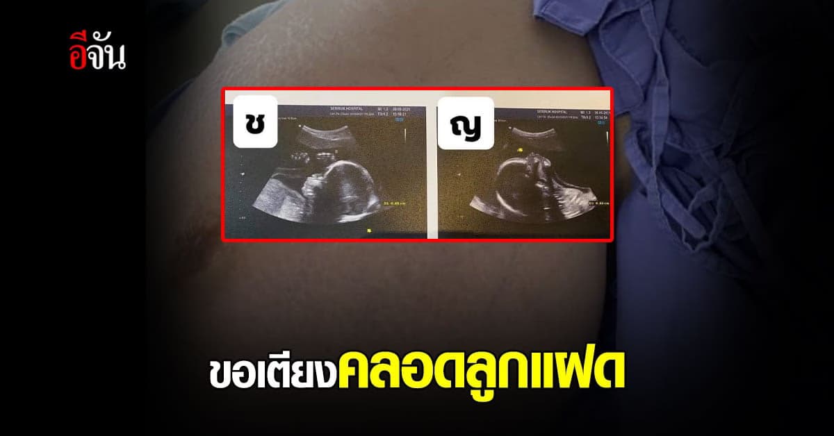สาวท้องแก่ เคยป่วยโควิด ใกล้คลอดลูกแฝด ขอเตียงผ่าคลอด