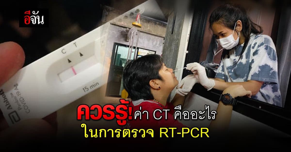 หมอแล็บแพนด้า โพสต์ อธิบาย ค่า CT คืออะไร ? ในการตรวจ RT-PCR