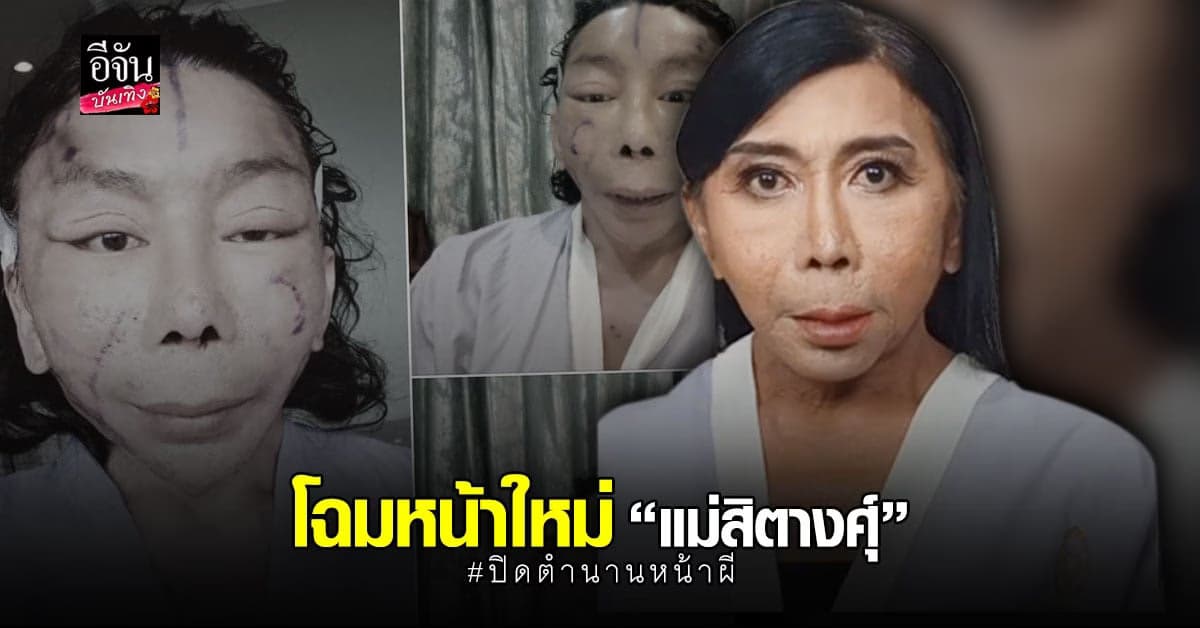 แม่สิตางศุ์ เผยหน้าใหม่หลังขึ้นเขียงผ่าตัดดึงหน้า ลั่น ปิดตำนานหน้าผี