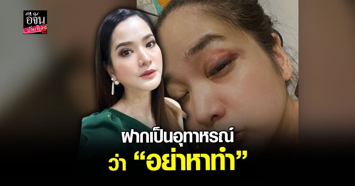 หวิดหน้าพัง! ปอย ปวีณา โชว์รอยช้ำจาก อุบัติเหตุสเก็ตบอร์ด