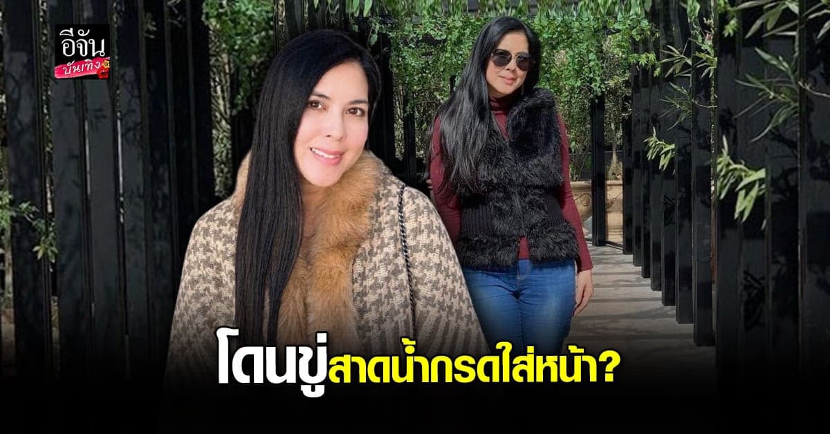 แบม จณิสตา ย้อนเล่าอุบัติเหตุหวิดโดนตัดขา