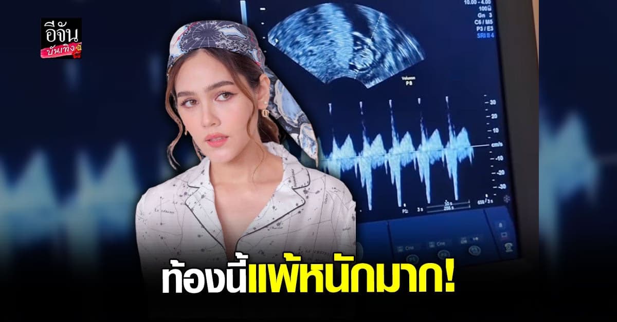 ชมพู่ อารยา แพ้ท้องหนัก รับพยายามมา 2 ปี เสียน้ำตาก็มี กว่าจะได้ลูกสาว
